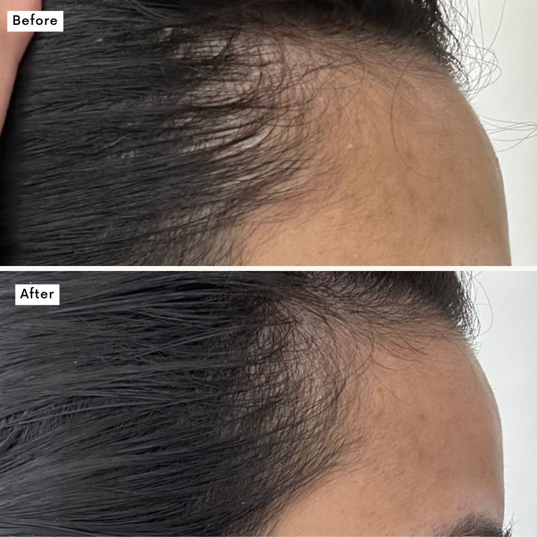 Hair Growth Supplement