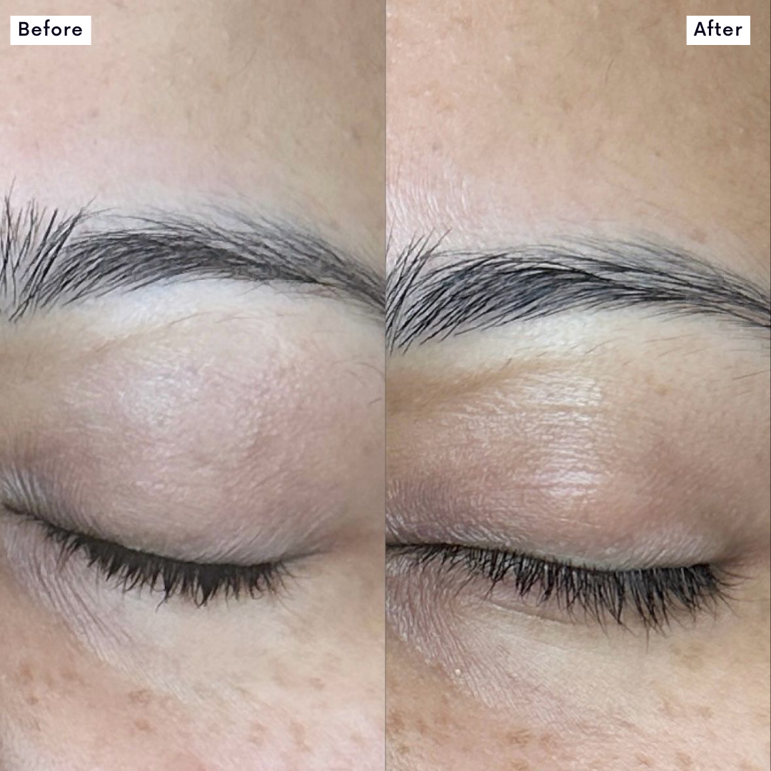 Miracle Brow & Lash Growth Serum