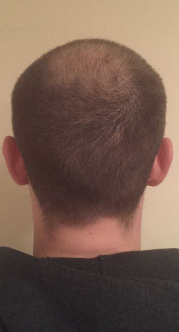 Before