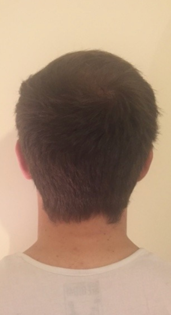 After