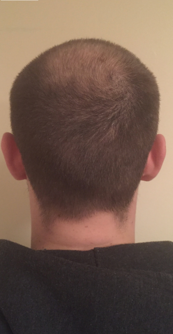 Before