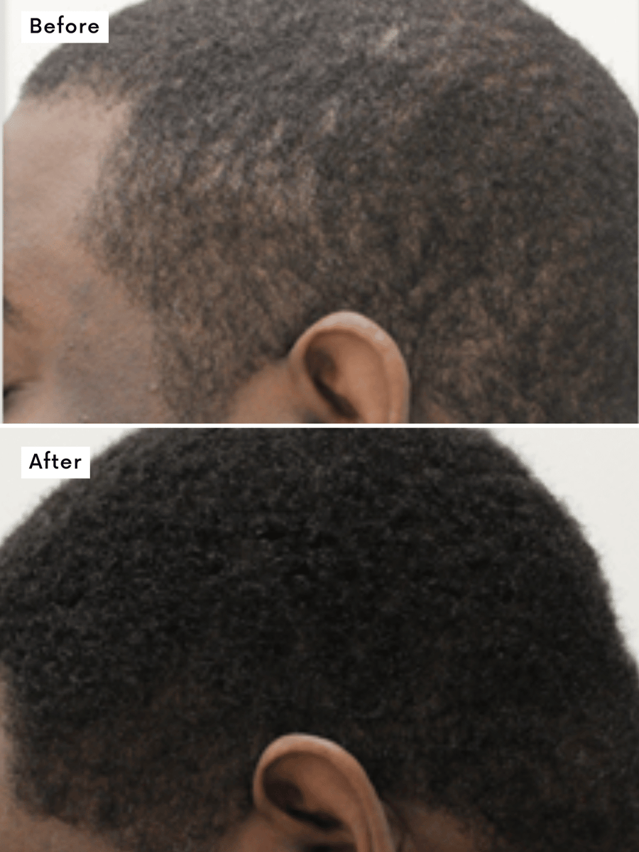 Hair Growth Treatment view 2